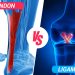 ligament vs tendon