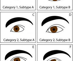 Decoding Diverse Asian Eye Shapes
